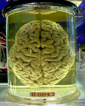 cerebro4